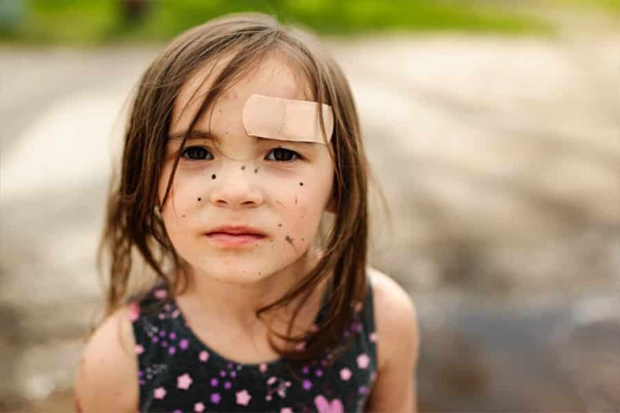 Meisje met pleister door ongeluk op nieuwe plein